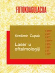 Fotokoagulacija. Laser u oftalmologiji