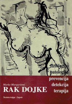 Rak dojke